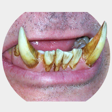 Накладные челюсти/зубы «Остроклык»